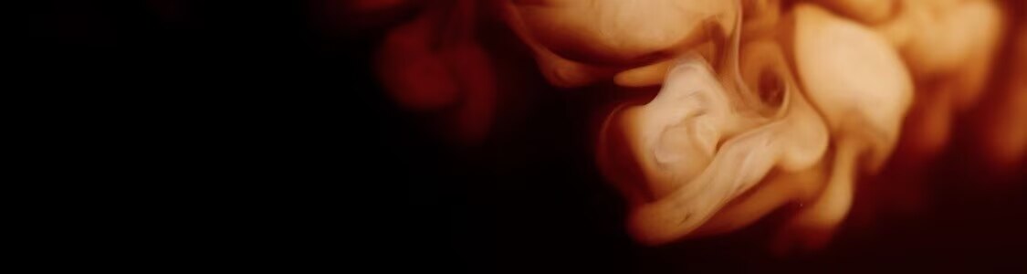 Formato Promocional banner